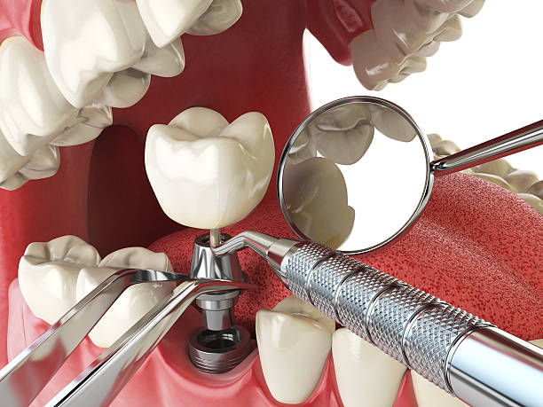 Best After-Hours Emergency Dentist in Oak Forest, IL